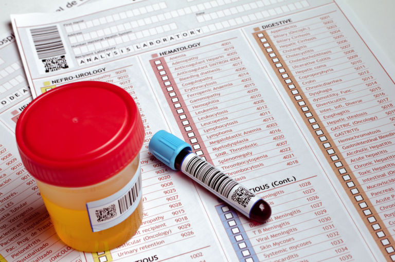 What Does it Mean When You Have Blood in Your Urine?